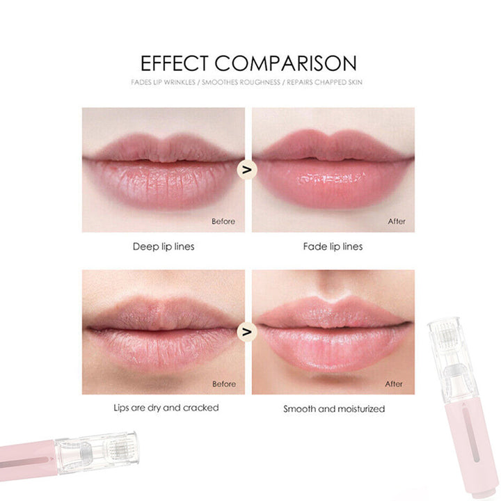 Yifeng High-Frequency Lip Massager
